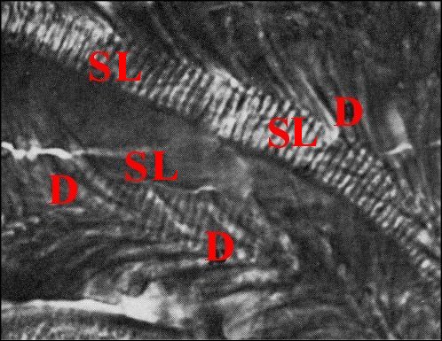 Bulbe spermatophore 2