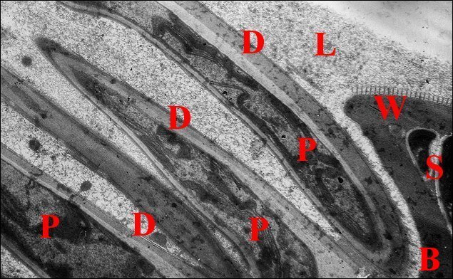 Digitations spermatophore 1