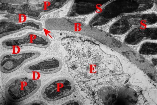 Digitations spermatophore 2