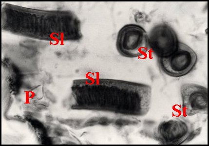 Spermatophore apneumonella 2