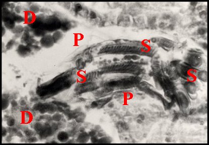 Spermatophore Apneumonella 1