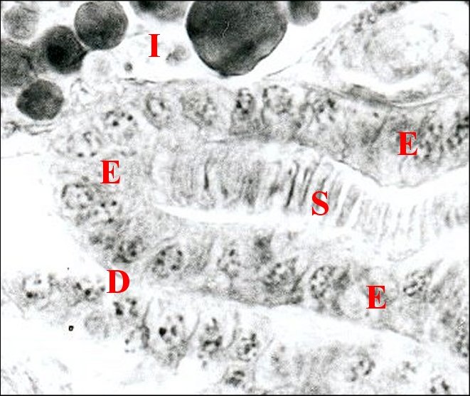 Spermatophore déférent 1