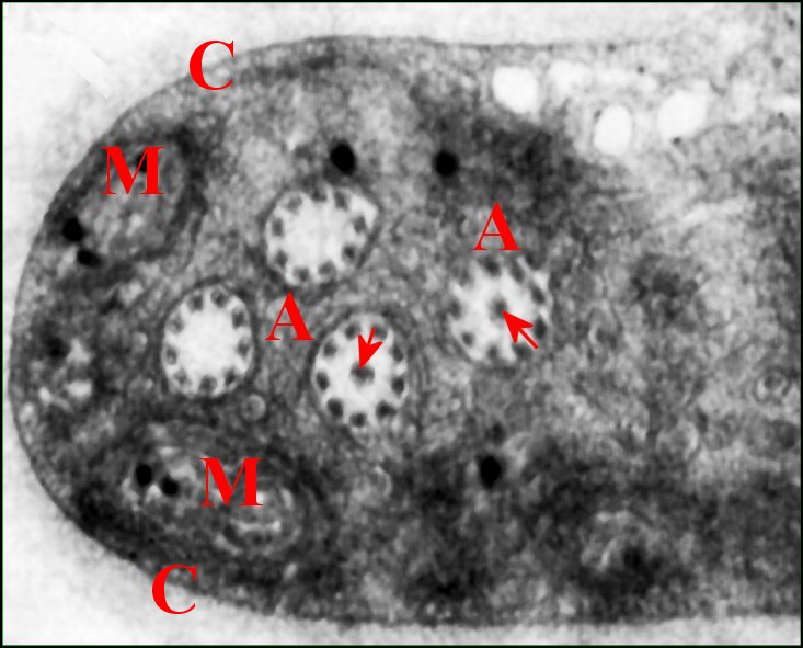 Spermatozoïde 1